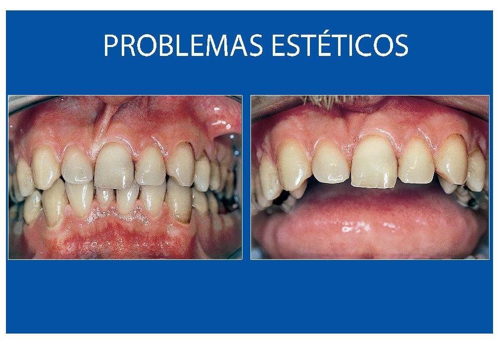Linia Estetica